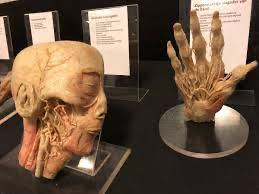 Anatomisches Präparat von Kopf und Hand
