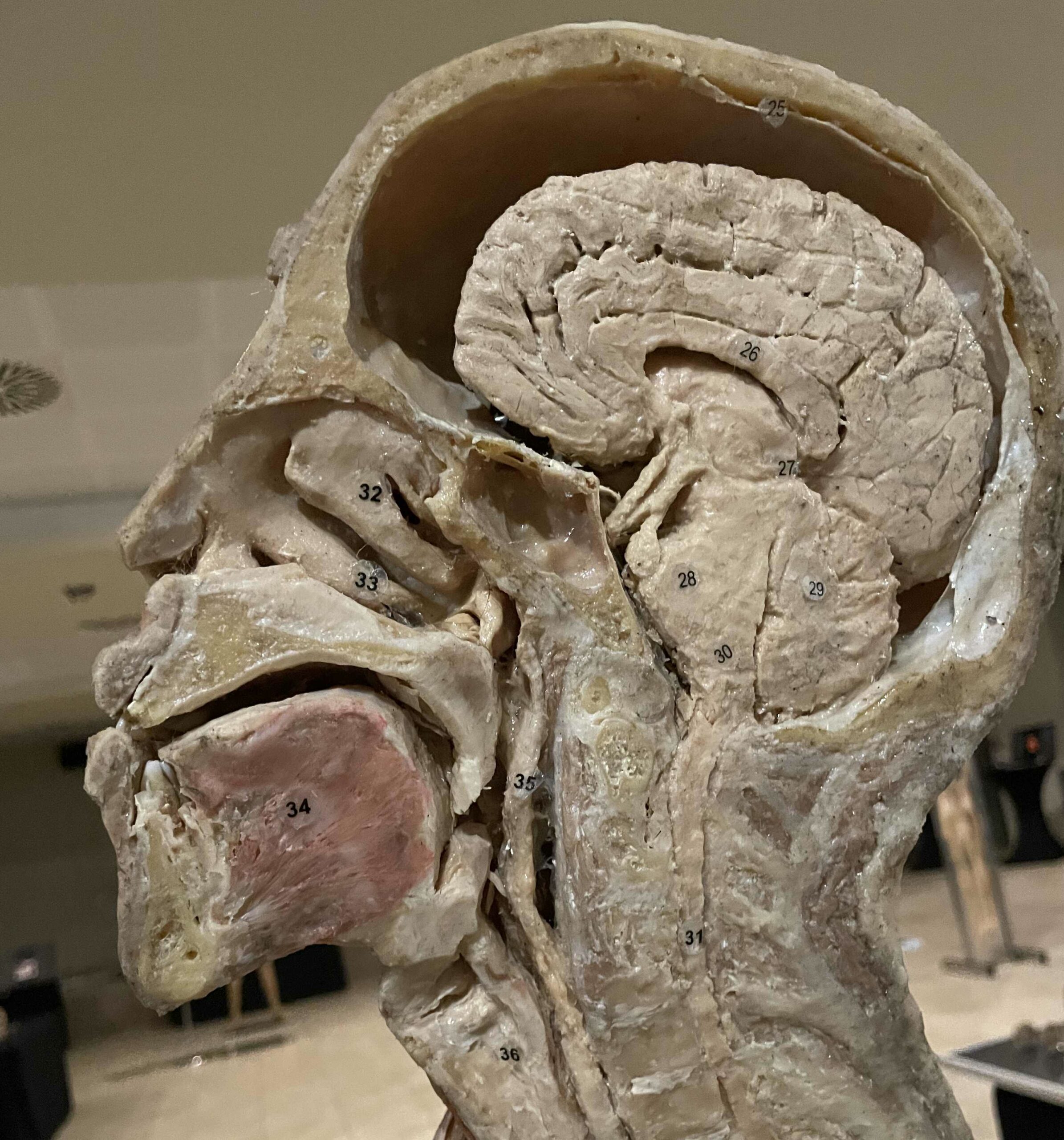 Anatomische Ganzkörperpräparate